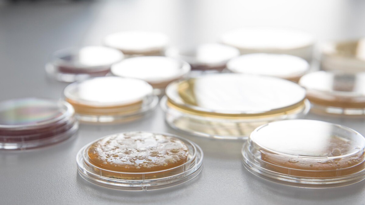 Isolierte Mikroorganismen auf Agarplatten. Die Kultivierung und Identifizierung von Mikroorganismen ist ein wichtiger Bestandteil mikrobiologischer Forschung an der HFU.